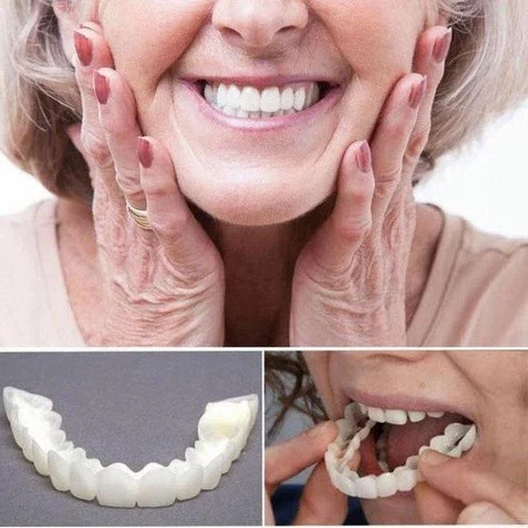 Brehn | On Smile Veneers (Ober- und Unterkiefer inbegriffen)
